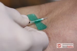Pobieranie krwi żylnej