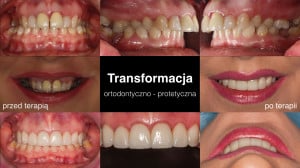 plakat_orto-protet_transform