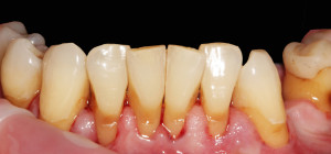 zdjęcie 2 - widok od przedsionka – aparat fotograficzny