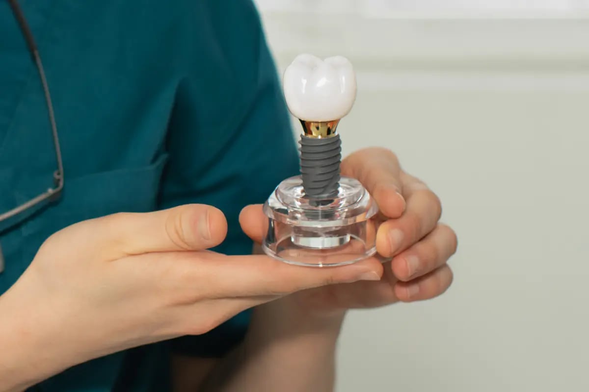 Czy implanty zębów trzeba wymieniać