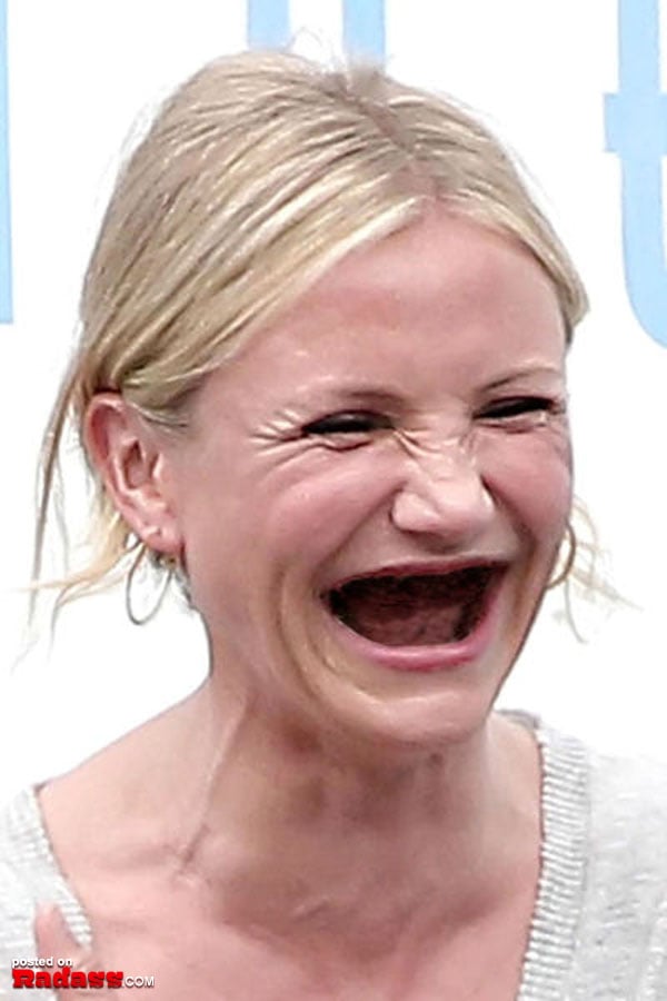 Toothless woman lounging on a bed with her mouth open.