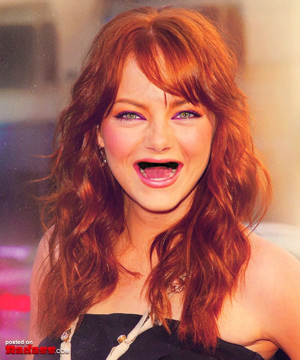 Toothless woman lounging on a bed with her mouth open.