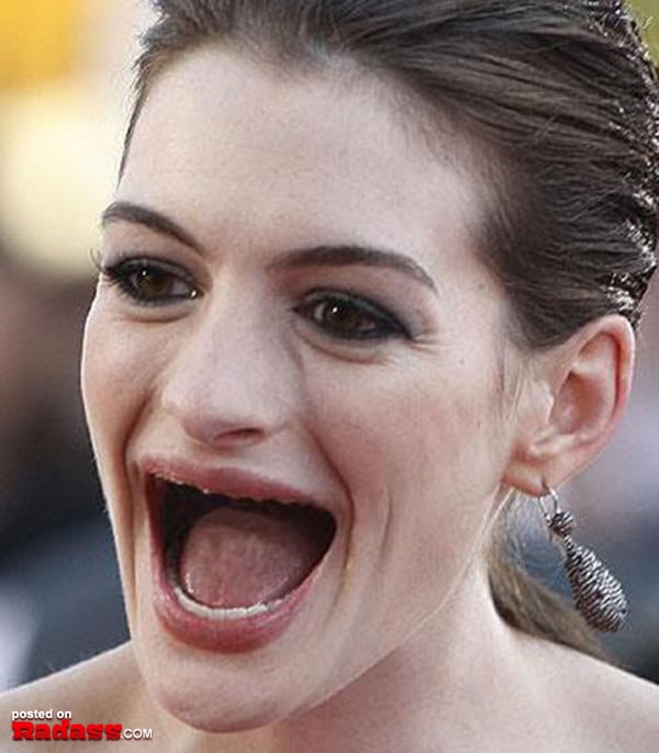 Toothless woman lounging on a bed with her mouth open.