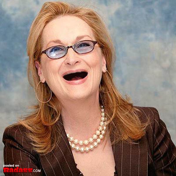 Toothless woman lounging on a bed with her mouth open.