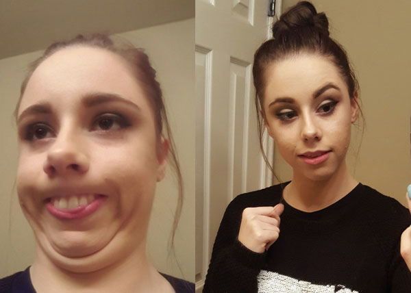 Pretty girls with ugly faces. (32)