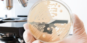 רפואה סינית כטיפול בפטרת וגינלית