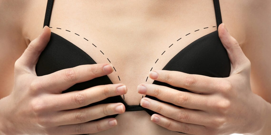 Young female body with marks for plastic operation, closeup