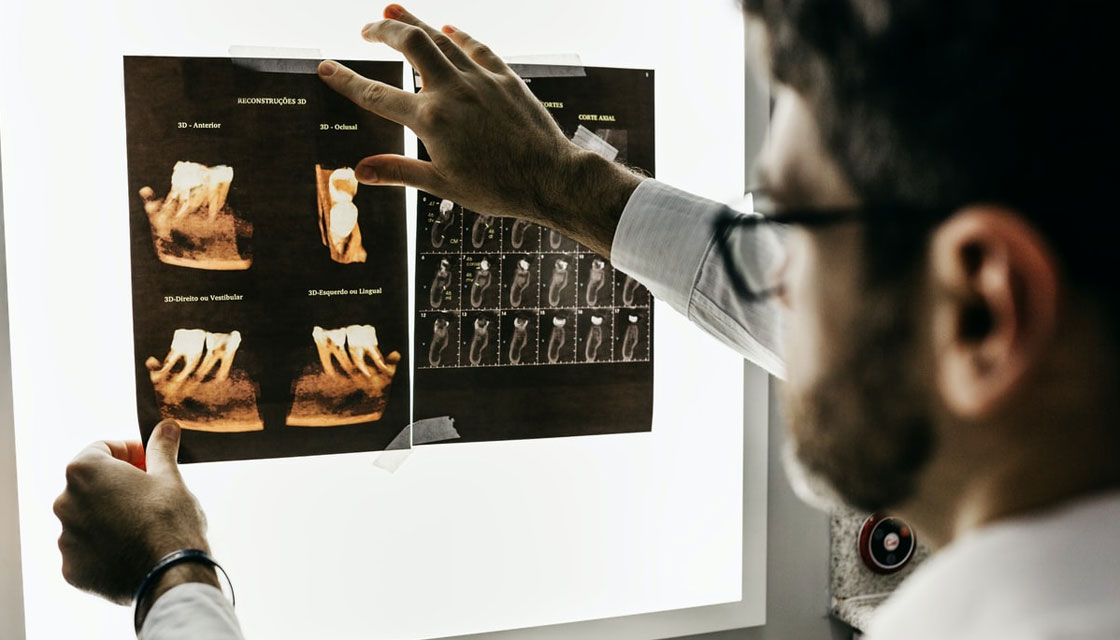 rtg zębów szczecin - gdzie je wykonać ile kosztuje