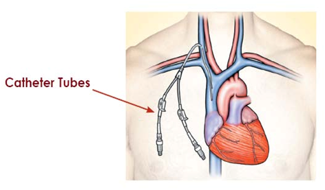chirurgie vasculaire tunisie