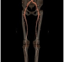 ANGIO-SCANNER ANGIO-SCANNER