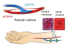 meilleur chirurgien vasculaire tunisie