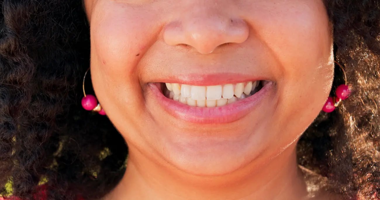 Ropień okołozębowy