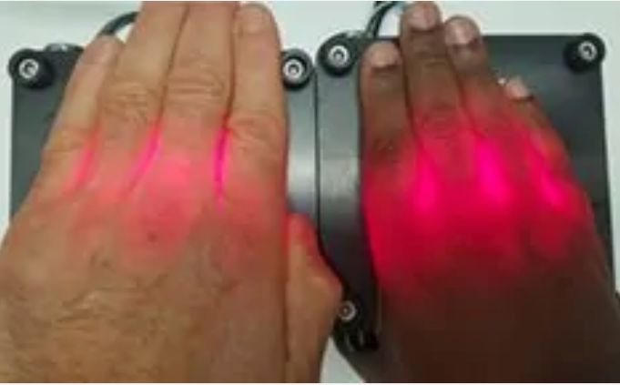 absorción de fotones en la piel blanca y oscura, terapia de luz roja penetración de luz roja en la piel