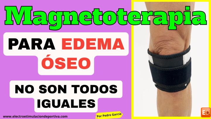 Tratamiento para edema oseo. ¿Por qué no funciona?