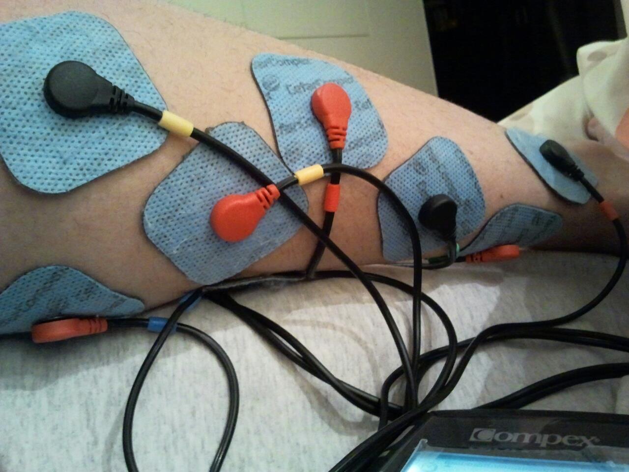 Colocación electrodos programa TENS da itual no te marques muchos objetivos cuando entrenes con electroestimuldores