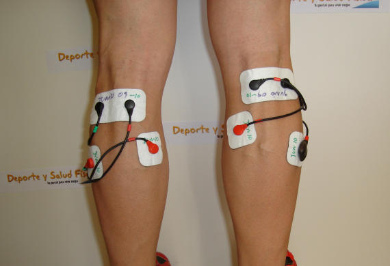 electroestimulación y varices Electroestimulacion y varices. https://www.electroestimulaciondeportiva.com/