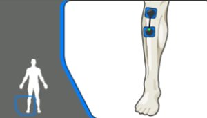 estiramiento Tibial electroestimulación