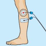 Pictorama prevencion esguince tobillo electroestimulacion usa el programa fuerza explosiva para la prevención de esguince de tobillo