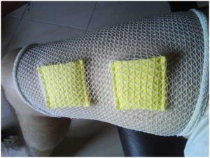 Como fabricar parches o electrodos de electroestimulacion caseros