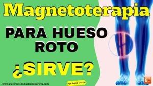 Magnetoterapia hueso roto