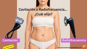 Qué es la cavitación y qué es la radiofrecuencia