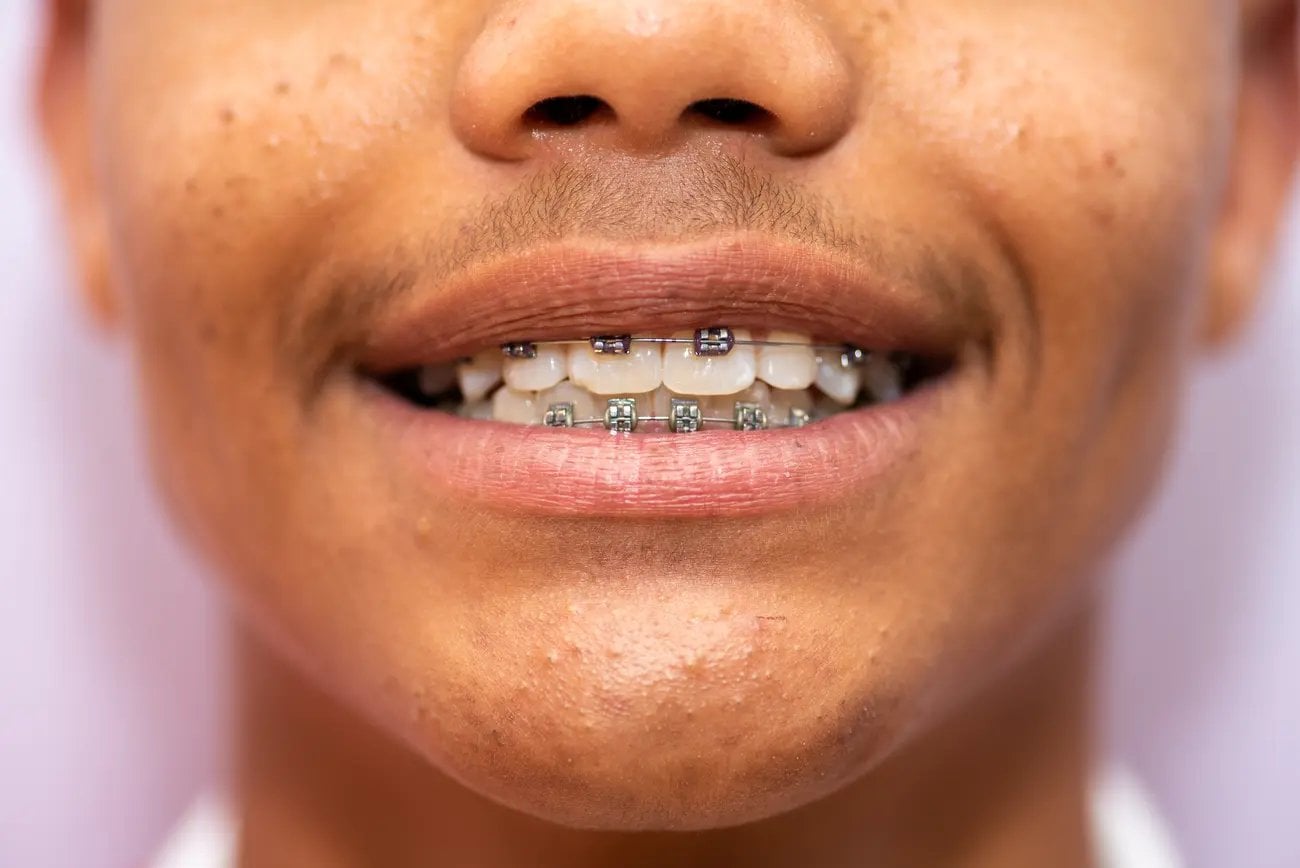 Aparat Damon Wrocław