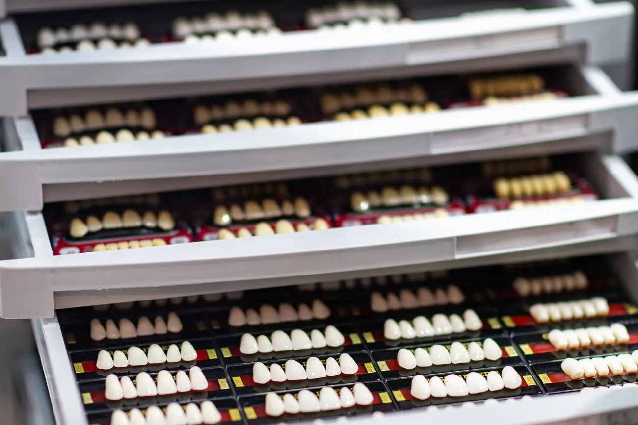 Na ile zębów zakłada się licówki? Licówki na zęby – wskazania i opis zabiegu