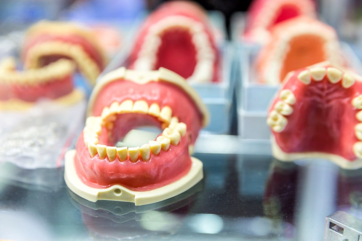 Ile trwa zrobienie protezy zębowej