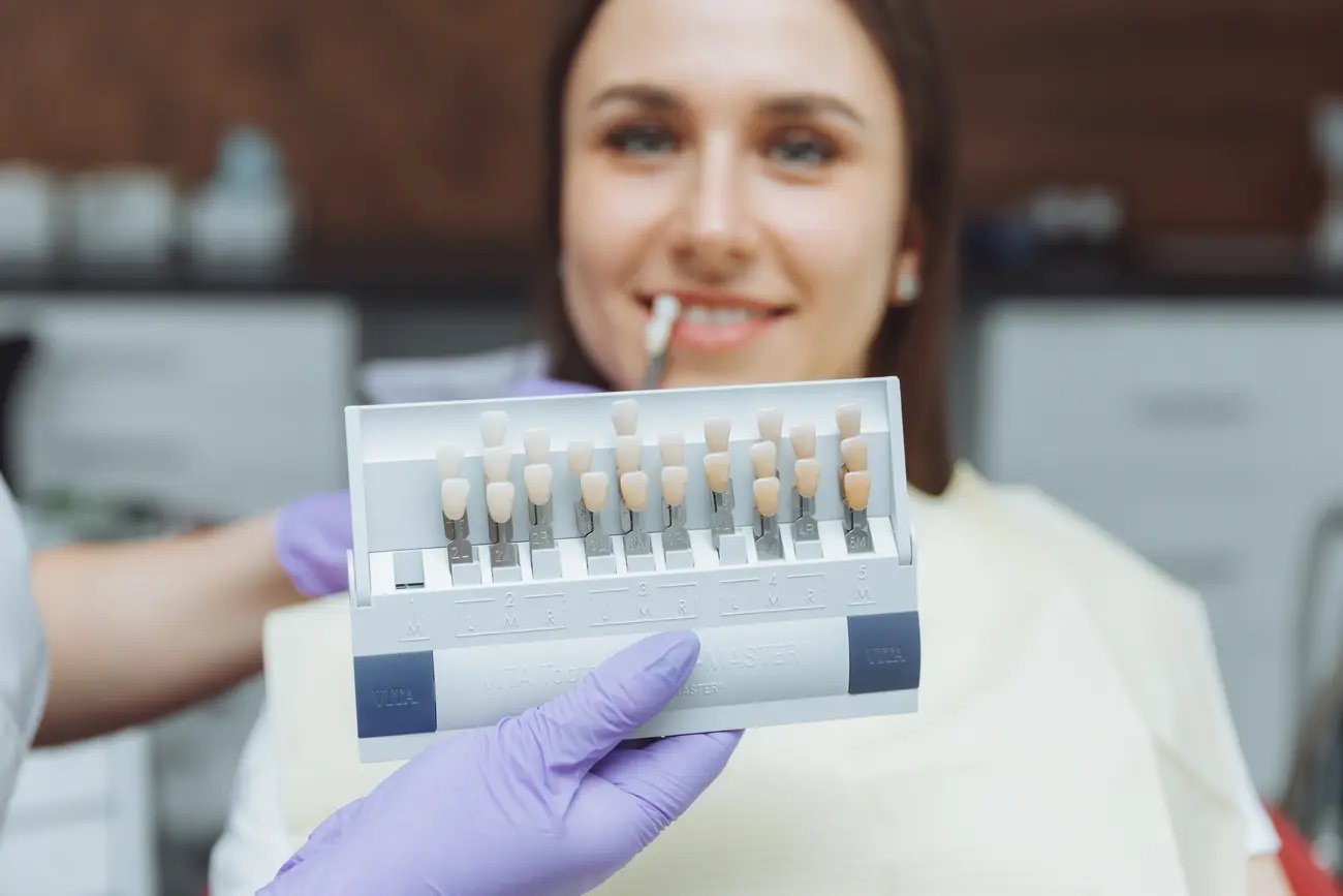 Licówka na martwy ząb – co trzeba wiedzieć przed założeniem?