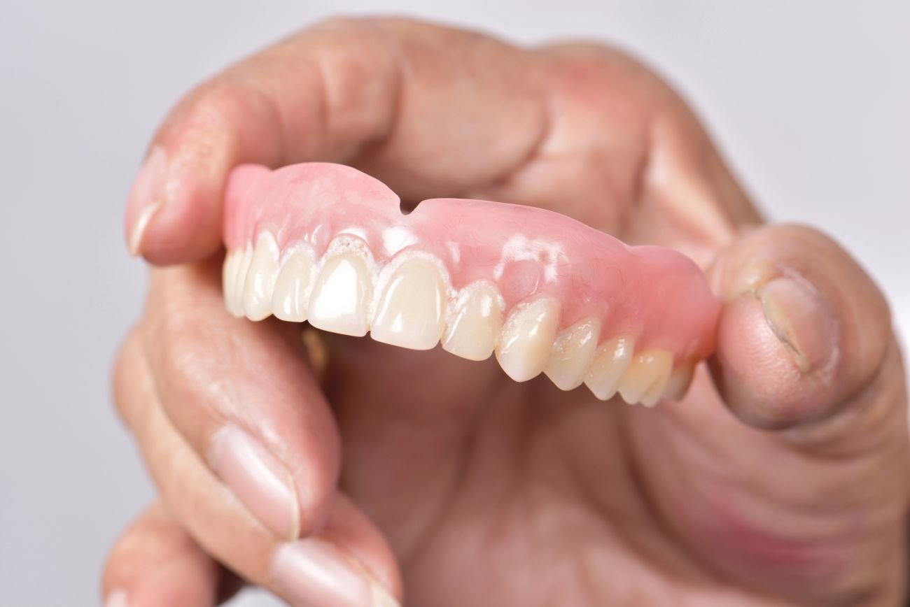 na ilu implantach proteza górna