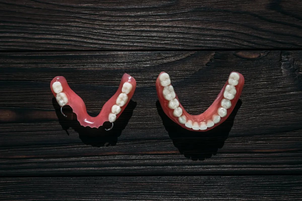 Kiedy warto robić zęby metodą All on 4