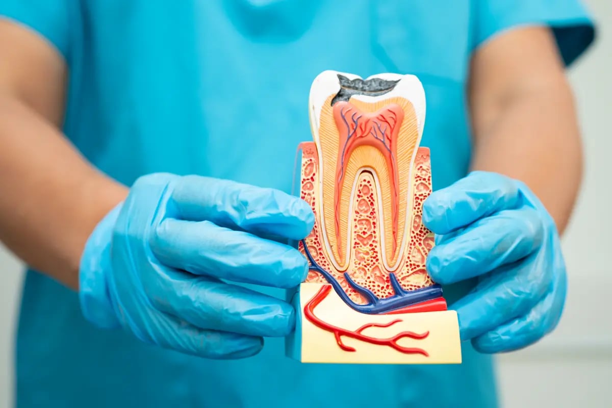 Leczenie kanałowe krok po kroku