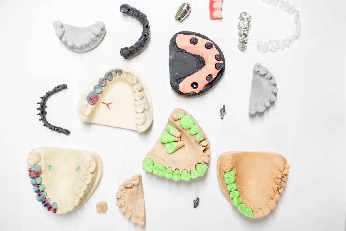 Jak wygląda most na zębach