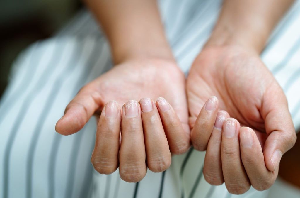 Nail Diseases And Homeopathy