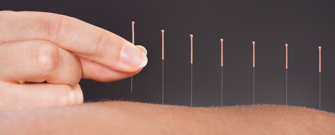 acupuncher-treatment-in-mohali Acupuncture in Chandigarh