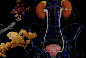 Urinary Tract Infection