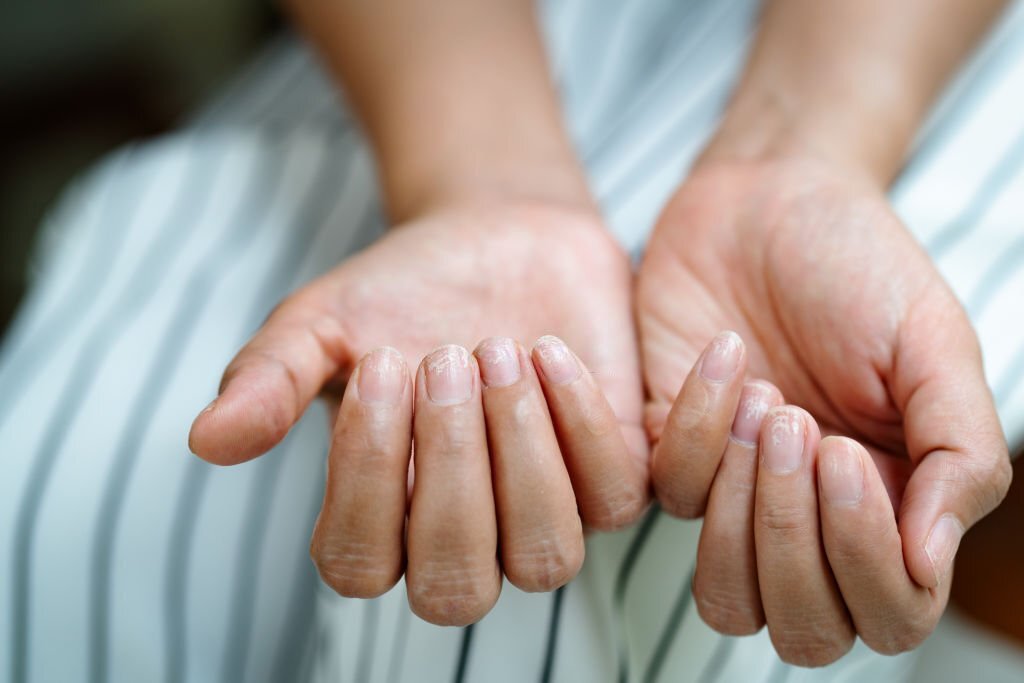 Nail Diseases And Homeopathy