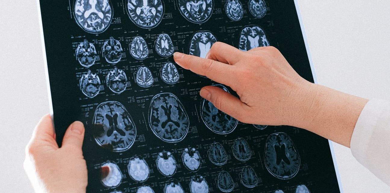 Problemy neurologiczne