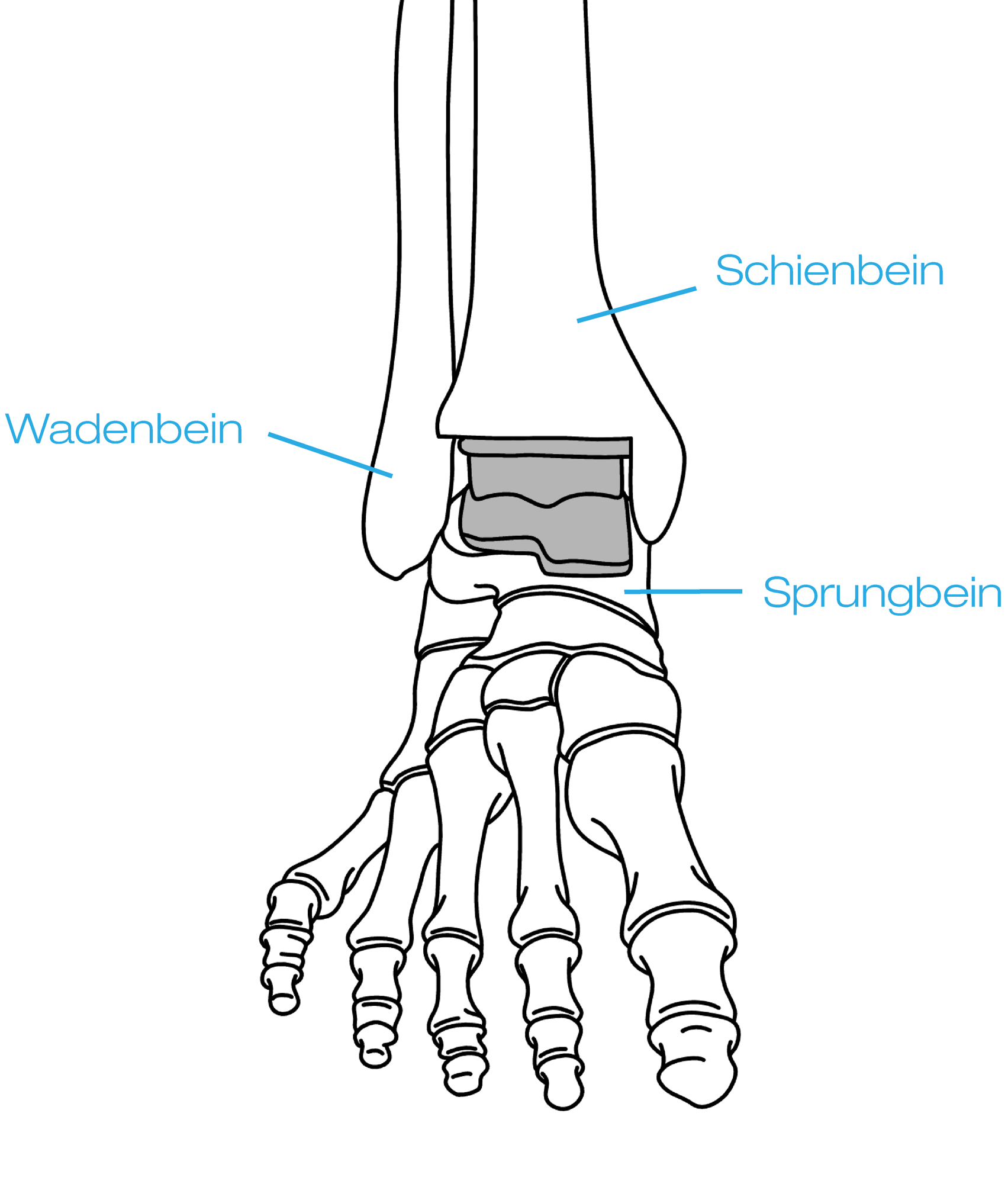 Sprunggelenksendoprothese img-7