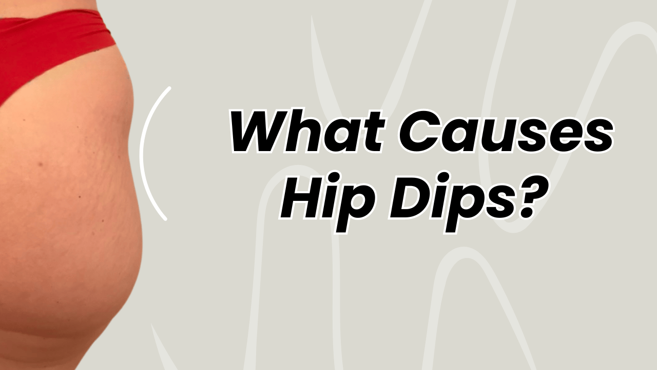 Unveiling the Genetic Mysteries Behind Hip Dips | What Causes Hip Dips?