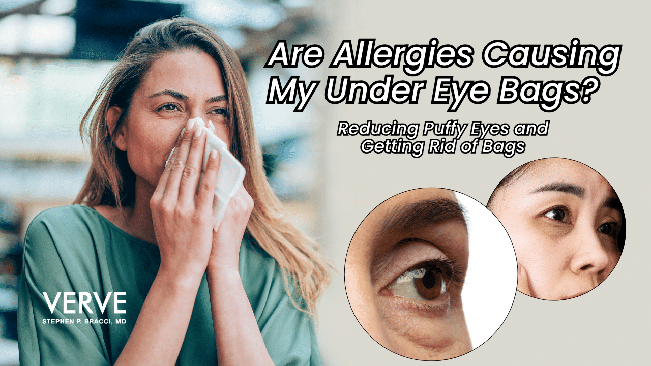 Are Allergies Causing My Under-Eye Bags? Reducing Puffy Eyes and Getting Rid of Bags