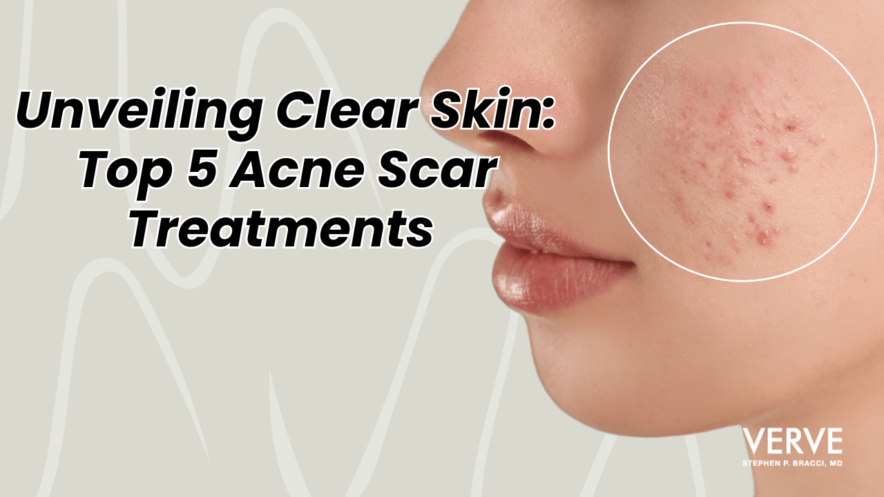 Unveiling Clear Skin: Top 5 Best Acne Scar Treatments | What is the Best Treatment for Acne Scars?