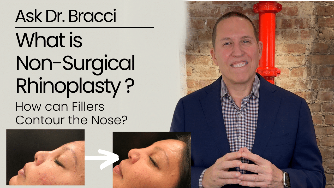 What is Non-Surgical Rhinoplasty and How can Fillers Contour the Nose?