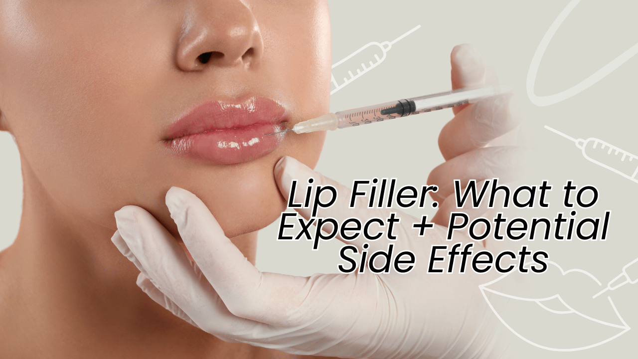 Lip Filler: What to Expect + Potential Side Effects | Dermal Filler for Lip Augmentation