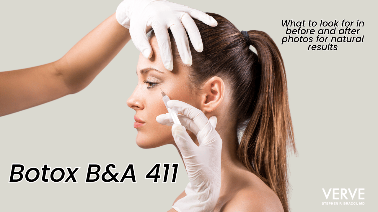 6 Thing to Look for in Botox Before and After Pictures: Cosmetic Injectables for Anti-Aging