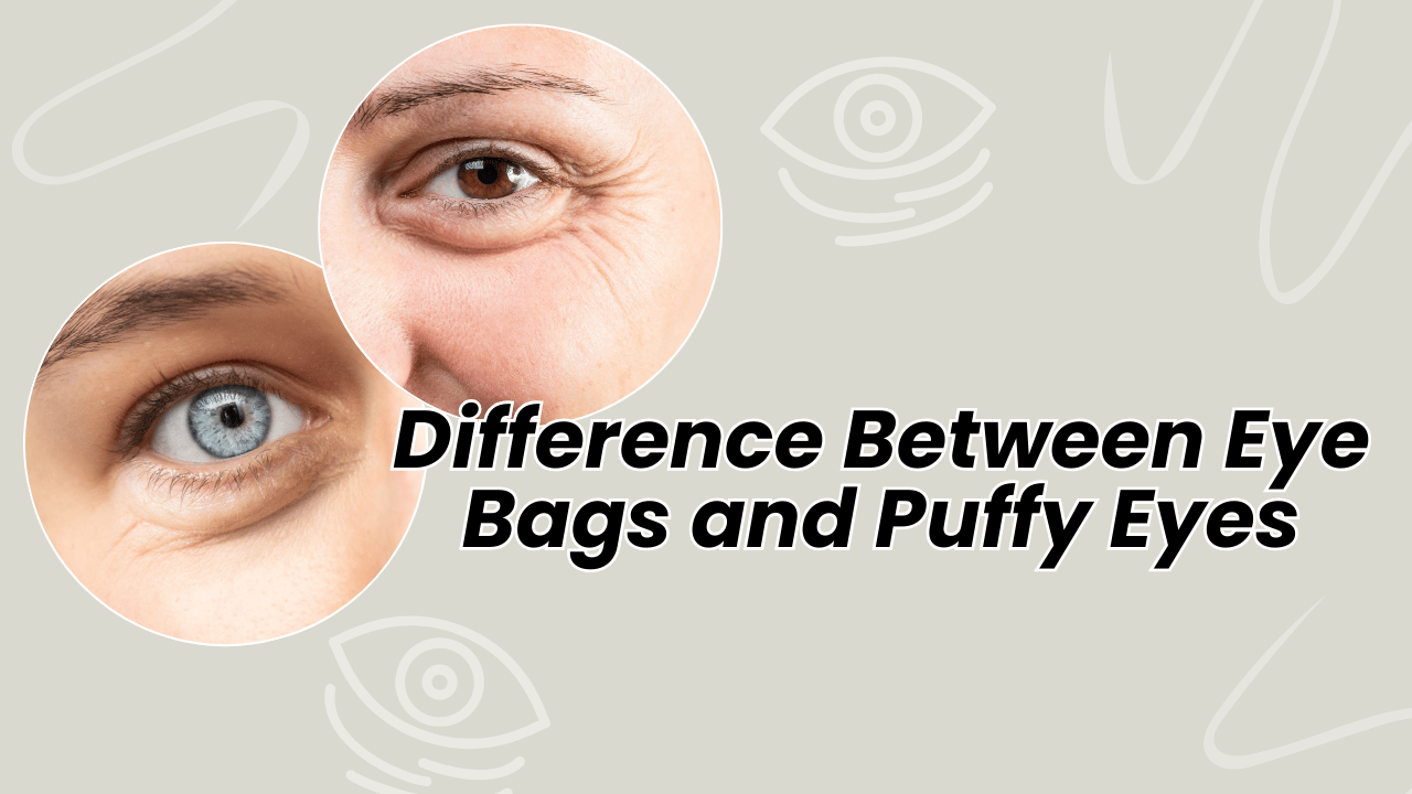 Difference Between Eye Bags and Puffy Eyes | Treating Eye Bags and Puffiness