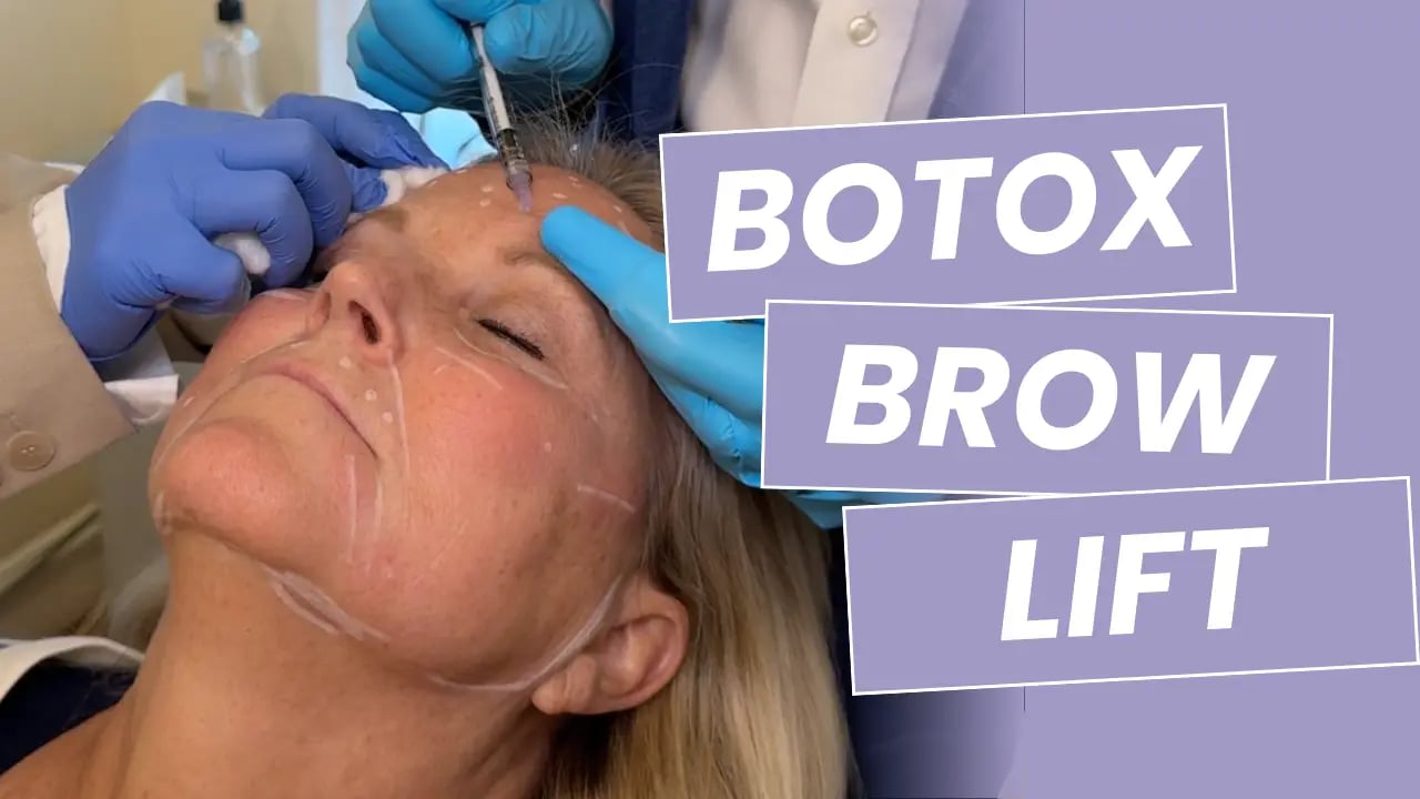 Image of a woman receiving botox in her brow area with title text reading "Botox Brow Lift"