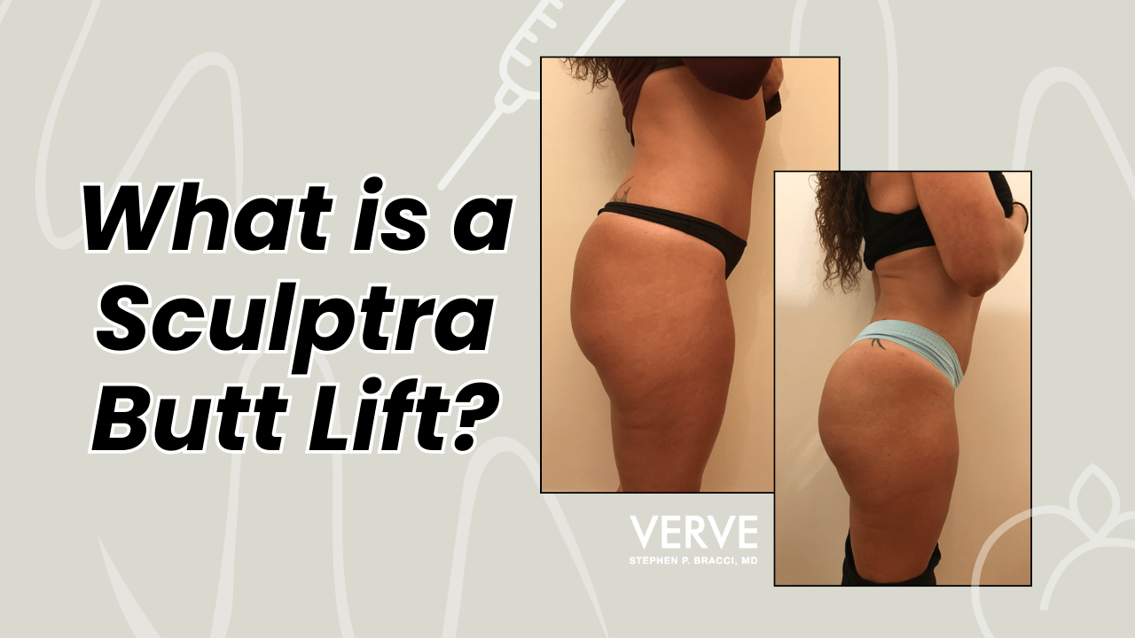 What is a Sculptra Butt Lift? | Non-Surgical Butt Lift Procedure