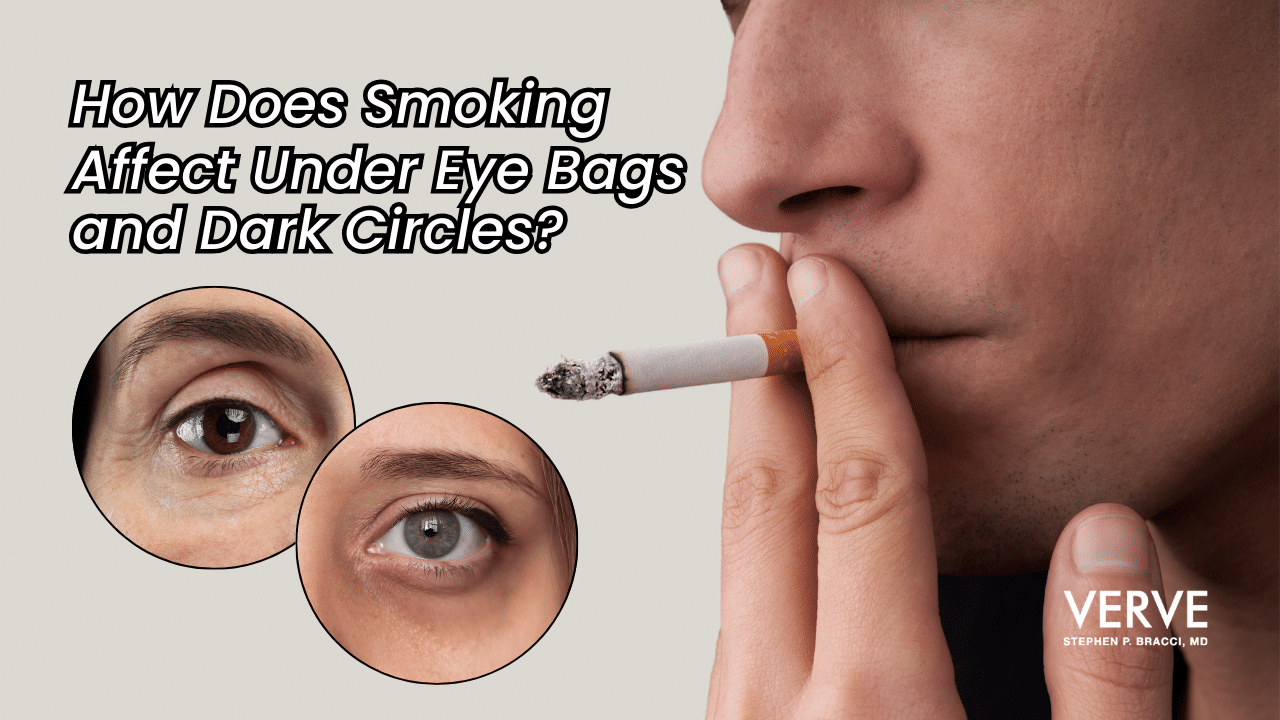 How Does Smoking Affect Under Eye Bags and Dark Circles?