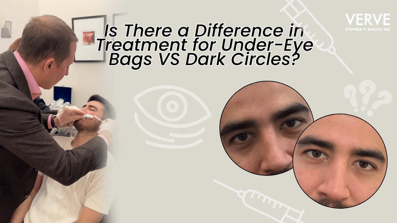 Is There a Difference in Treatment Options for Under-Eye Bags VS Dark Circles?